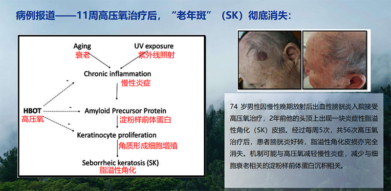 微壓氧艙3.jpg